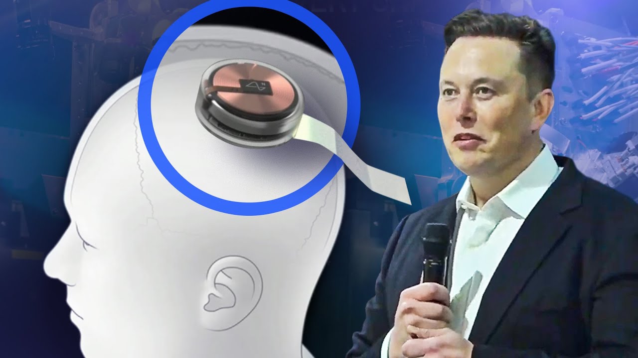 AI brain-chip technology of Elon Musk, Neuralink, where he had twins with a senior executive